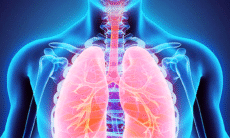 TB diagnosis