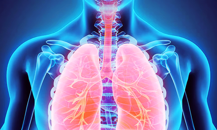 TB diagnosis